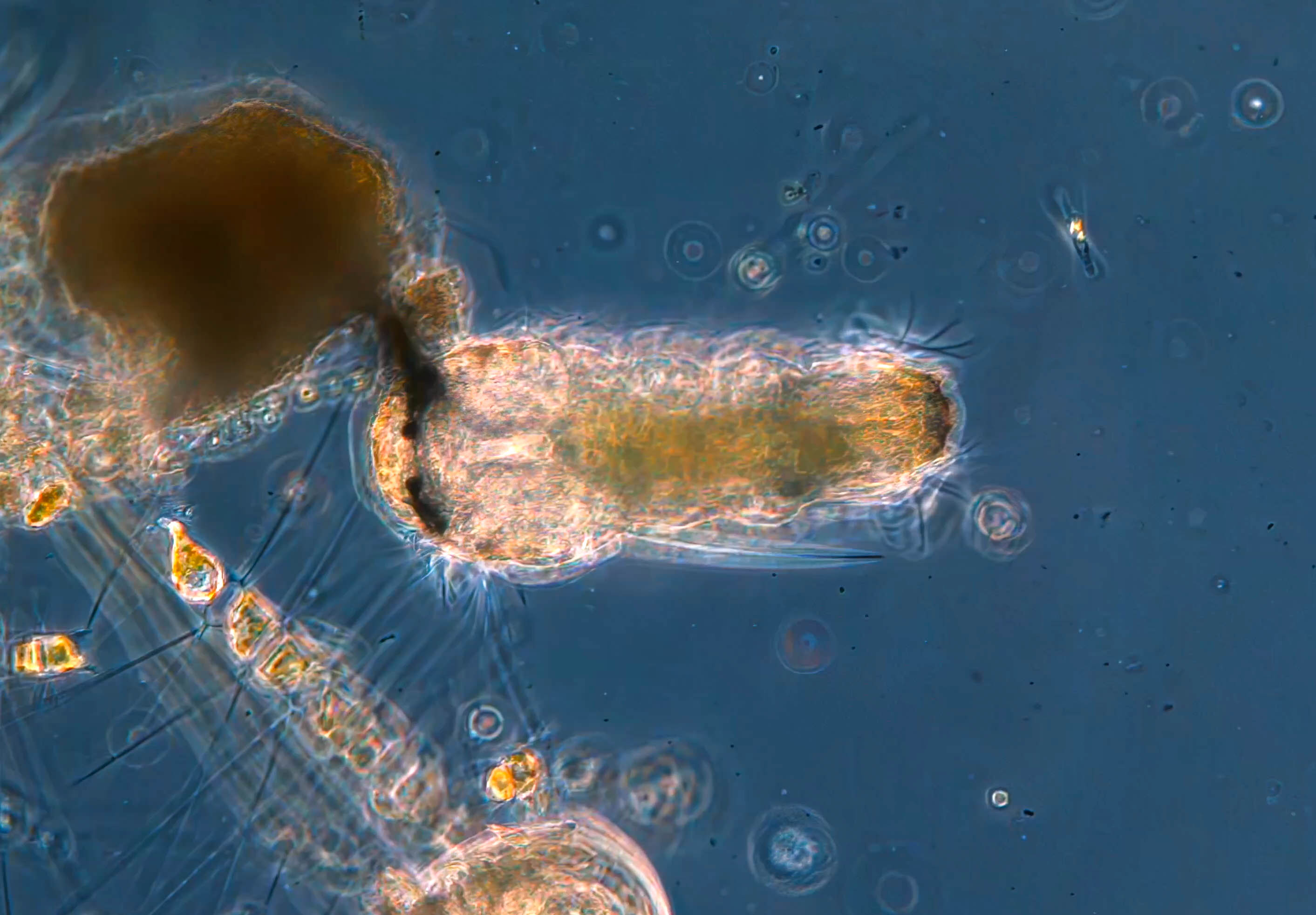 polychaete cilia slow motion