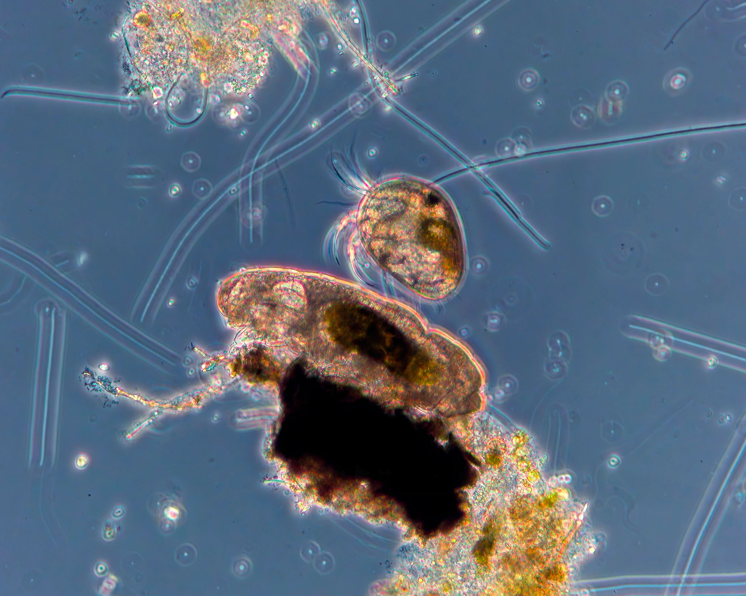 Tardigrade and Ostracod