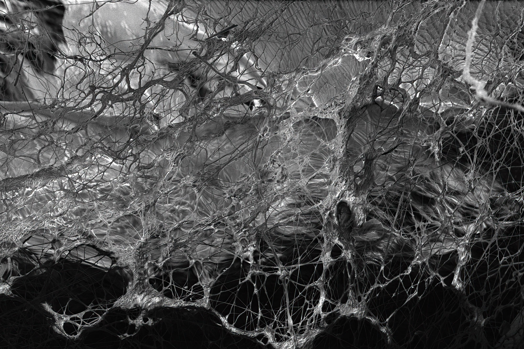 Scanning Electron Microscopy