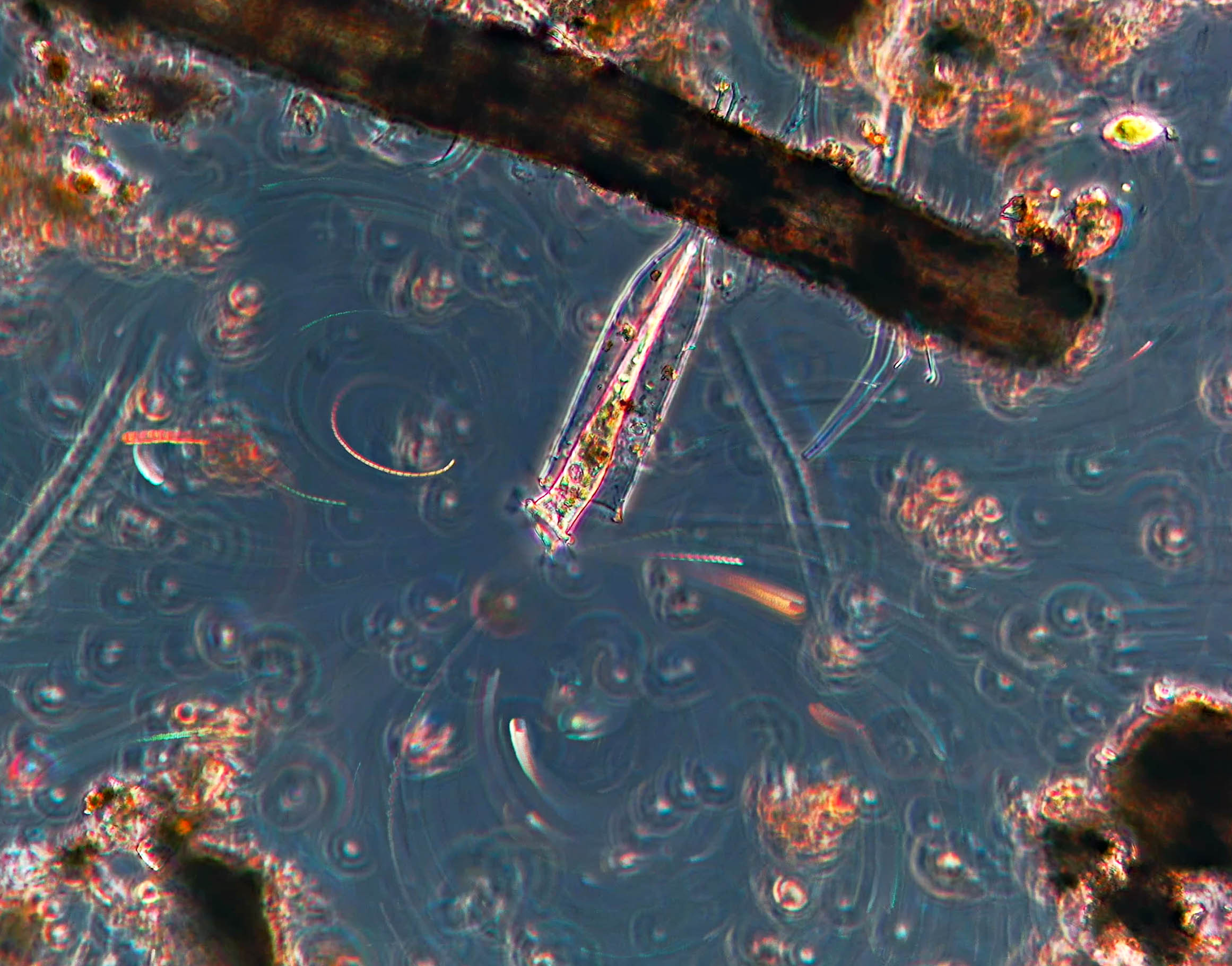 Charles river ciliate feeding currents vid