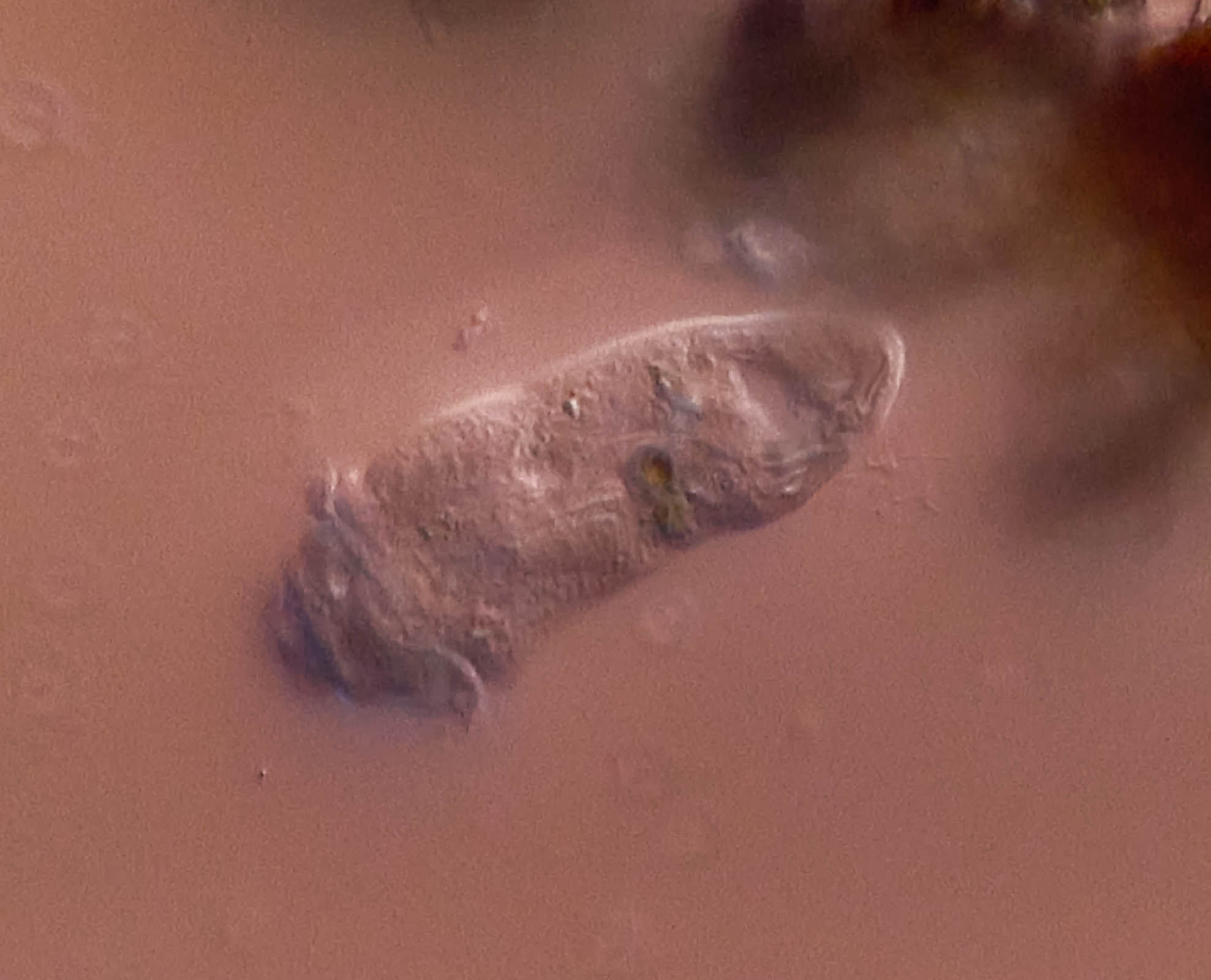 ciliate gets bashed Charels river 3-21-24