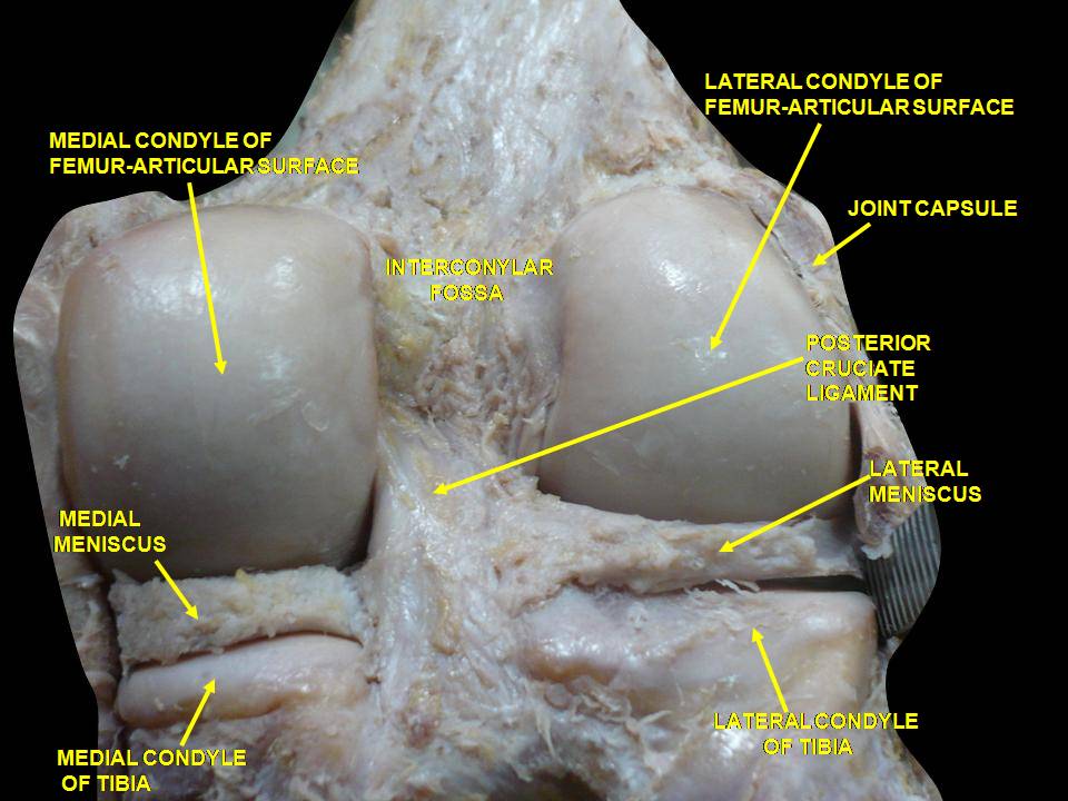 Meniscus anatomy vascular zone.jpeg