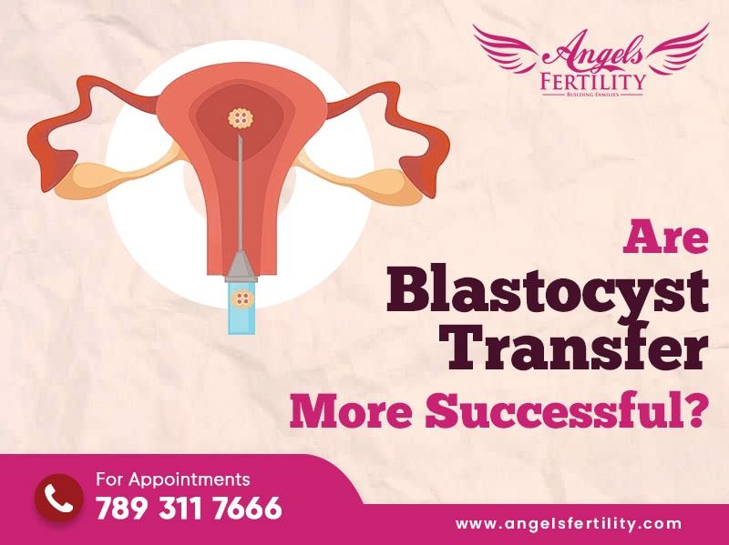 Are Blastocyst Transfers More Successful?