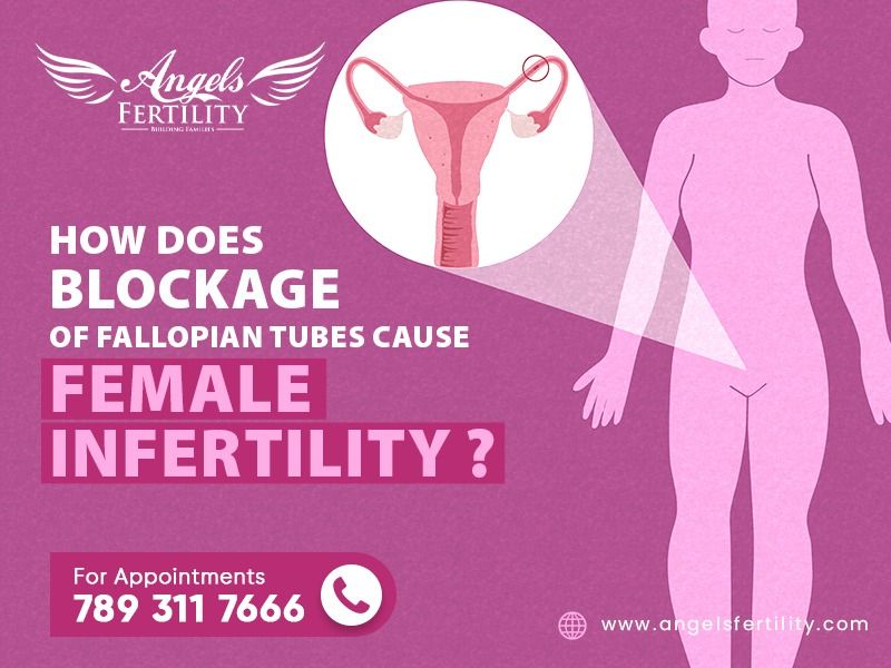 How Does Blockage of Fallopian Tubes Cause Female Infertility?