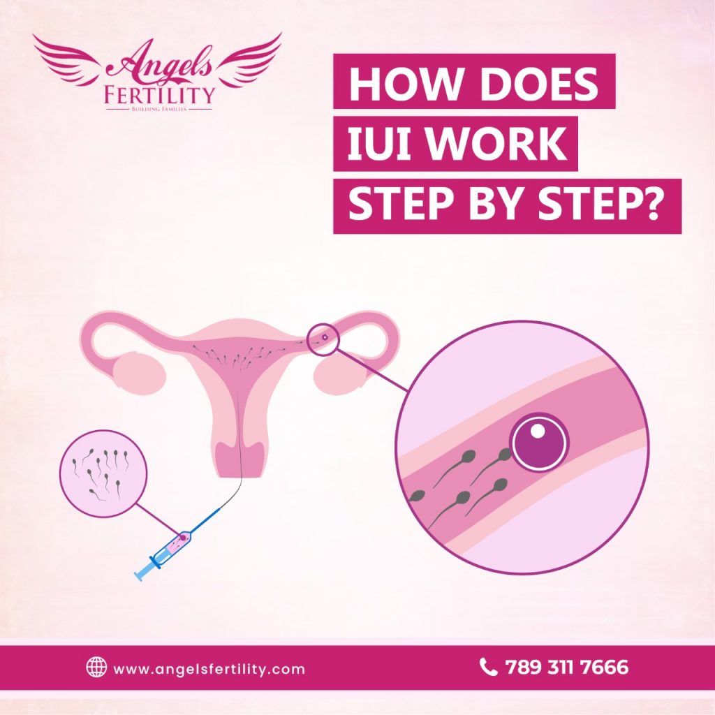 How does IUI work Step by Step