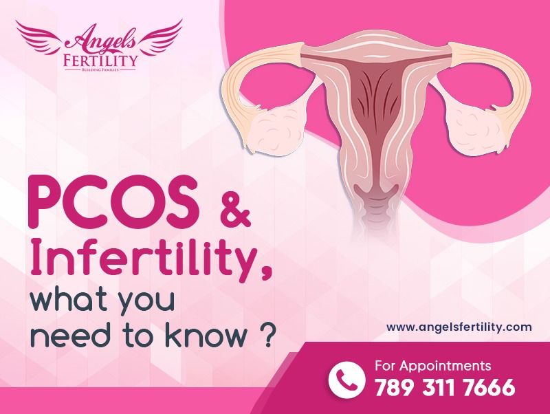 PCOS & Infertility – What you need to know ?