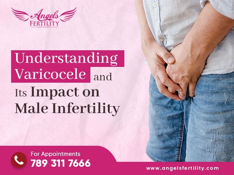 Understanding Varicocele and Its Impact on Male Infertility