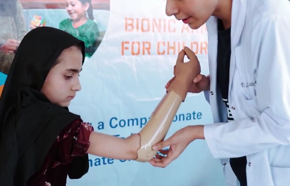 Prosthetic Limb Project