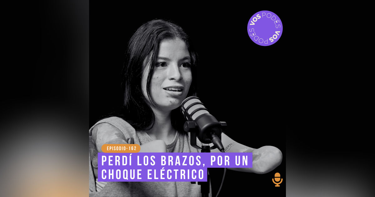 Perdí los brazos por un choque eléctrico - invitada: Karol Bastidas