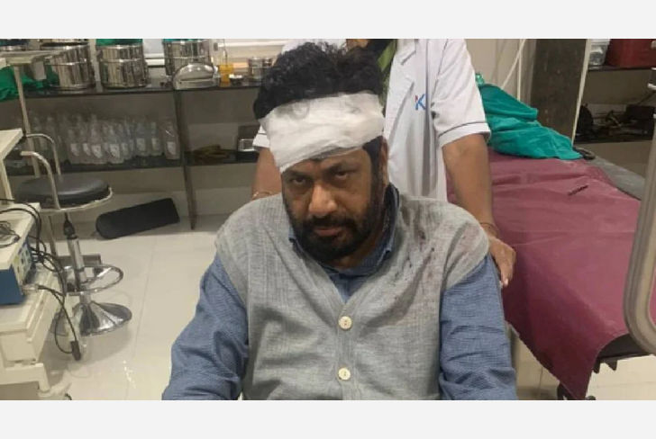 Bachu Kadu hit by a bike
