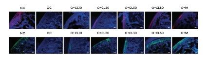 COL2A1 Expression in Knee Articular Cartilage