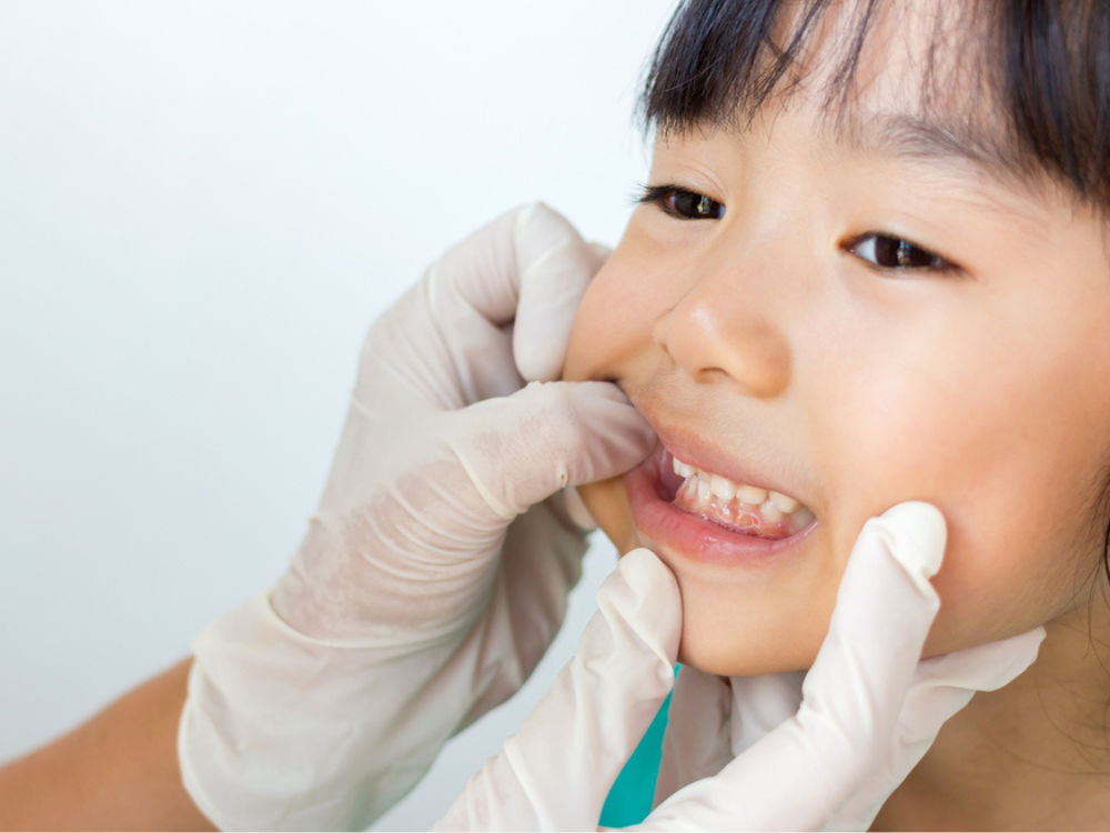 Imunisasi gigi (1).png