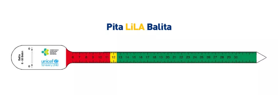 anak gizi kurang_2.jpg.jpg