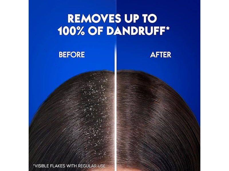 Head & shoulder hair shampoo anti dandruff 600 ml moisturizing scalp care