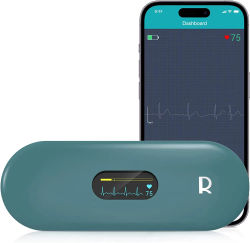 Monitor de ECG Portátil OLED con Bluetooth, Monitorización Cardíaca, Electrocardiograma Portátil, Almacenamiento de Datos Ilimitado, Compartible