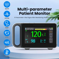 Monitor de Pacientes Multiparamétrico Portátil E7A, Pantalla Táctil de 7 Pulgadas, Monitor de Signos Vitales, ETCO2 Opcional