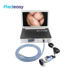 Cámara endoscópica médica Full HD con fuente de luz fría LED de 30W y Monitor de 11,6 pulgadas