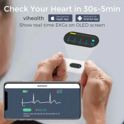 Dispositivo de Monitoreo de ECG de Bolsillo con Pantalla OLED, Monitor de EKG Bluetooth para Forma de Onda Rítmica, Análisis por IA con Aplicación Gratuita para iOS/Android