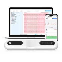 Monitor ECG monitor holter | Resultados fáciles en 30S-24H | Análisis AI gratuito Recordar ECUOS de un solo plomo en la marcha y detectar irregulares