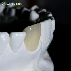 Ceradirect SHTC pre-shaded dental zirconia Zirkon zahn system(95mm) thickness 25mm—— for dental lab CAD/CAM