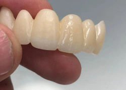 ST+ML 9516mm super translucency multilayer zirconia dental blocks zirkonzahn cad cam zirconia blank