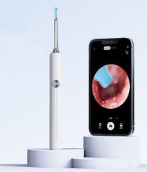 SMART OTOSKOP ØRERENSE KAMERA VOKS FJERNING WIFI ANDROID IOS 5MP