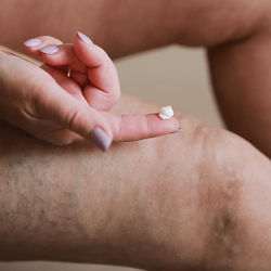 Vein Smoothing Varicose Veins Cream Vein Smoothing Varicose Veins Cream
