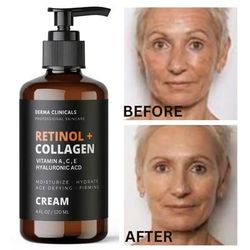 Retinol + Collagen, Hyaluronic Acid, Vitamin C AntiAging Wrinkle Serum Cream 4oz Retinol + Collagen, Hyaluronic Acid, Vitamin C AntiAging Wrinkle Serum Cream 4oz