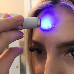 Innovative Anti Fungal Laser Pen With Cutting Edge Fungal Infections Removal And Safe for Skin Technology Innovative Anti Fungal Laser Pen With Cutting Edge Fungal Infections Removal And Safe for Skin Technology