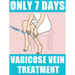 Laser treatment for varicose veins,ᴍᴇᴅɪᴄᴀʟ grade equipment, painless treatment for spider veins and blood in the legs