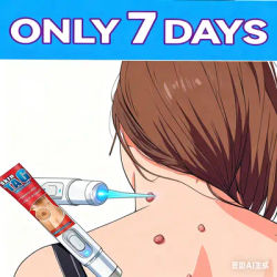 9Deep Sterilization Laser Pen Treatment for Flat Warts Condyloma Acuminatum and Various Warts Physical Painless Removal of Warts