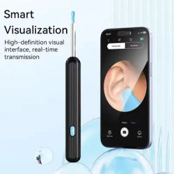 Smart Visual Ear Cleaner with Camera Ear Sticks USB C Charging Ear Wax Removal Tool WIFI Connection 6 LED Lights Earpick
