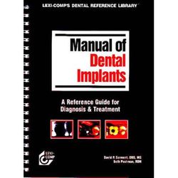 Lexi Comps Manual Of Dental Implants Lexi Comps Dental Reference Library