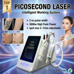 Top-level Picosecond Laser Q Switched Nd Yag Laser Tattoo Removal Machine for Salon Remove Tattoo Laser Machine Carbon Peeling