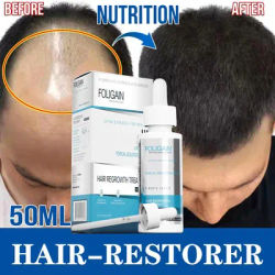 Hair Rapid Growth Spray for Men's Body and Chest and Eyebrows and Beard Thick Hair Treatment Loss