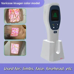 Venous Vascular Imaging Instrument Medical Beauty Medical Vascular Finding Instrument Limb Facial Display Instrument Infusion