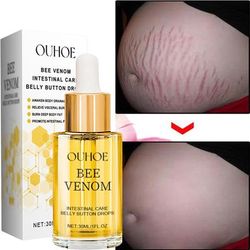 Postpartum Repair Essential Oil, Fade Stretch Marks Fat Lines, Big Belly Recovery Body Massage Oil Skin Whitening Care Postpartum Repair Essential Oil, Fade Stretch Marks Fat Lines, Big Belly Recovery Body Massage Oil Skin Whitening Care