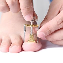 Ingrown Toenail Fixer Device Ideal Gift For Healthy, Pain Free Feet Ingrown Toenail Fixer Device Ideal Gift For Healthy, Pain Free Feet