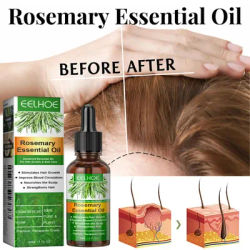 Rosemary Hair Growth Essentiall Oil Anti Hair Loss Products Repair Damage Dry Frizzy Serum Nourish Hair Scalp Follicles Care