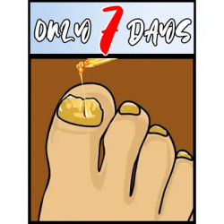 Technology changes life and says goodbye to onychomycosis