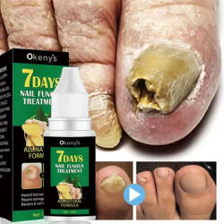 Extra Strong Nail Fungus Treatment Serum Essence oil piedi Nails Repair Care Essence Cream Anti