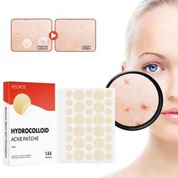 Professional Acne Patches, High End Skin Care Pimple Stickers For Healing & Absorbing Spots Professional Acne Patches, High End Skin Care Pimple Stickers For Healing & Absorbing Spots