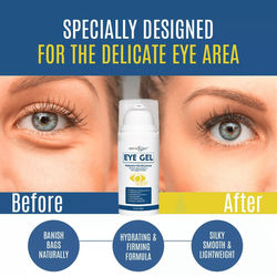 Anti Aging Eye Gel By Dermaxgen, Eye Bag Remover For Dark Circles, Crows Feet, Wrinkles, Lift & Firm Formula With Stem Anti Aging Eye Gel By Dermaxgen, Eye Bag Remover For Dark Circles, Crows Feet, Wrinkles, Lift & Firm Formula With Stem