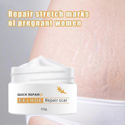 Arpienpoistovoide uusille ja vanhoille arpeille Stretch Mark Removal Gel voide naisille ja miehille