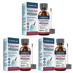 Extra Vahva Kynsisientä Korjaava Kynsineste - Korjaa Harmaat, Värjäytyneet ja Paksut Kynnet, Nopeasti Imeytyvä Kynsien Vahvistava Neste Kaikille Ky...