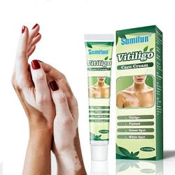 Vitiligo-voide, Vitiligo-hoitovoide