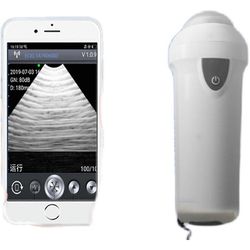 mickcara Kotitalous pieni raskaustesteri langaton mekaaninen eläinlääketieteellinen skanneri ultraääni hine sika lampaat karja