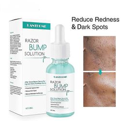 Partakoneen pistotulppa ajelemisen jälkeen hiusten kasvu hoito vähentää tummia täpliä punoitusta Partakoneen polttaminen Miehet ja naiset