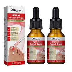 2kpl Ingrowth Varpaankynsien korjaushoito Öljy Sisäänkasvaneet varpaankynsien korjaustipat