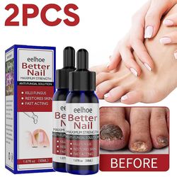 Yyelv 50ml Nail Treatment Solution Hand Foot Nail Repair Fuktighetsgivende Rensing Anti-sopp Nail Care Bright Solution 2 stk.